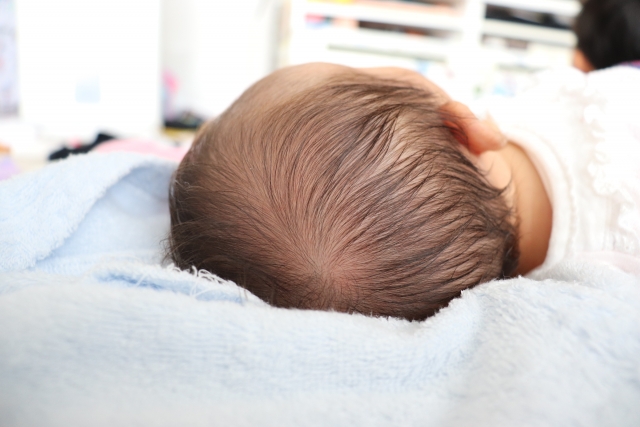 赤ちゃんの絶壁(短頭症)とは